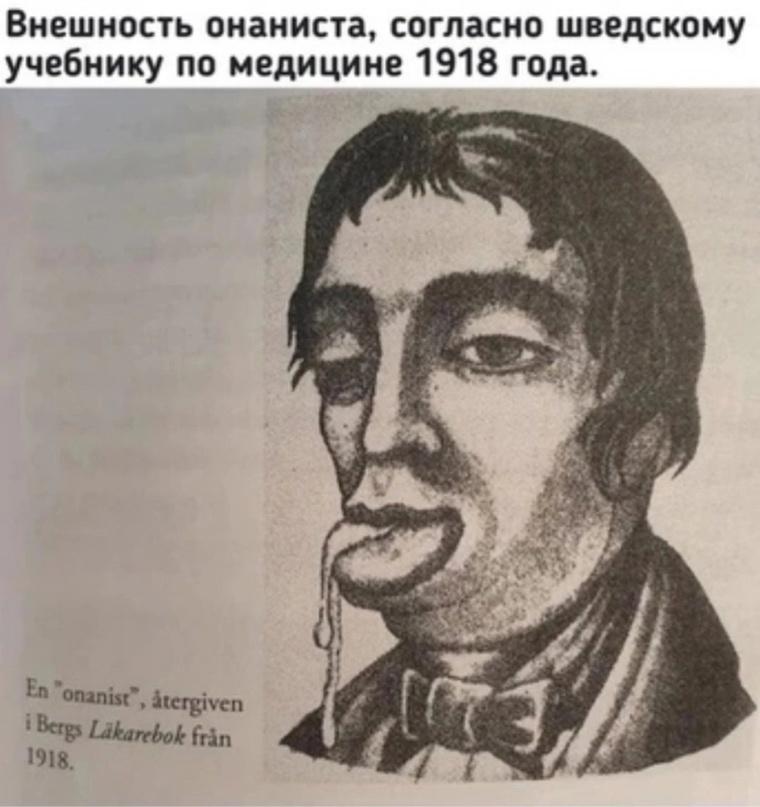 ﻿Внешность онаниста, согласно шведскому учебнику по медицине 1918 года.,Дрочибельные мемы,дрочево,дрочка,дрочеры,мастурбация