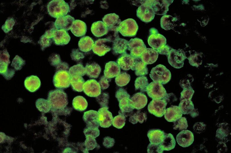 Техас,США,страны,амеба,Naegleria fowleri