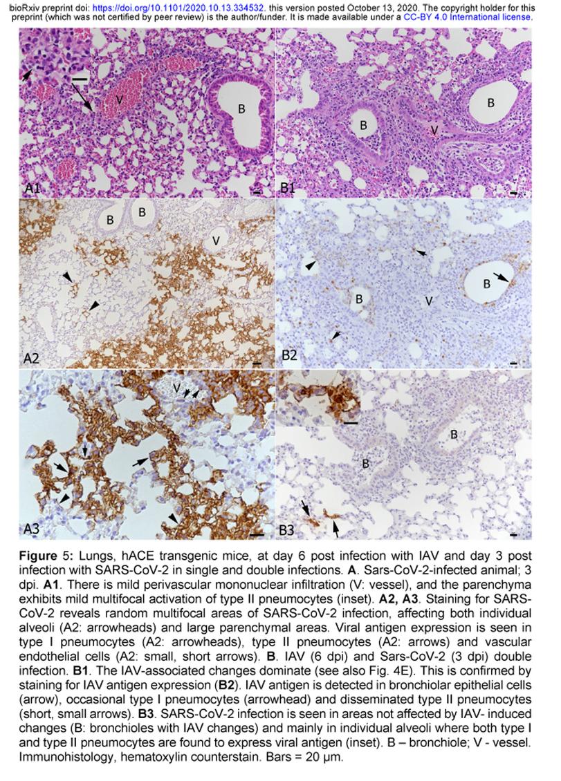 ﻿bioRxiv preprint doi: https://doi.org/lO 1101/2020.10 13.334532. this version posted October 13, 2020 The copyright holder for this preprint (which was not certified by peer review) is the author/funder. It is made available under a CC-BY 4.0 International license. Figure 5: Lungs, hACE